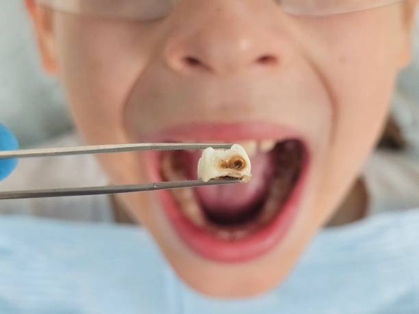 Best Emergency Dental Care for Sports Injuries in Red Lick, TX